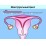 Нерегулярный менструальный цикл. Классификация нарушений, основные причины и симптомы сбоев